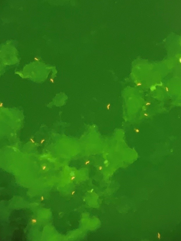 Case 63 Clinical Pathology Unknown Conference