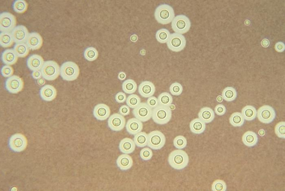 Photo credit: https://phil.cdc.gov/details.aspx?pid=3771